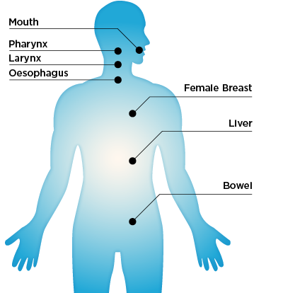 body-400x414px_v2